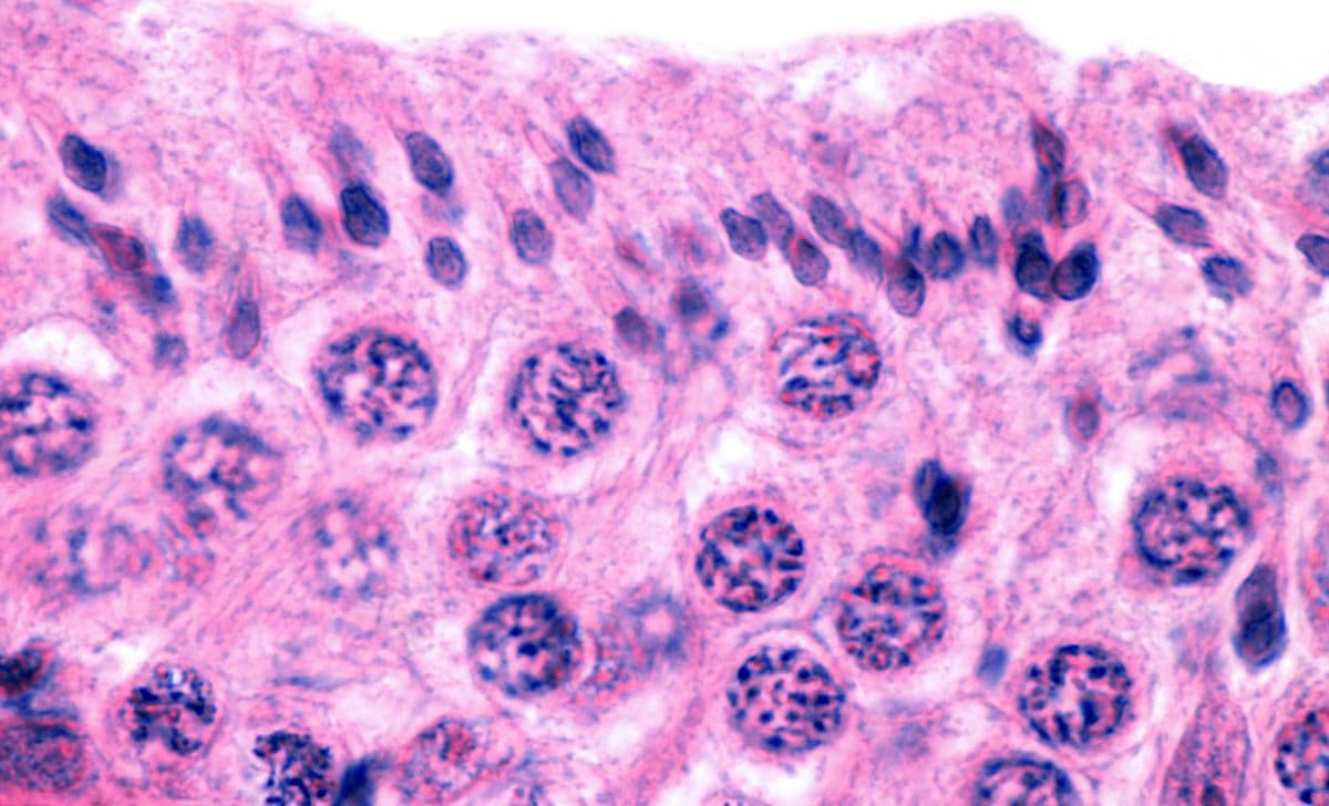 Spermatogenesis: Proses Produksi Sperma yang Menakjubkan!
