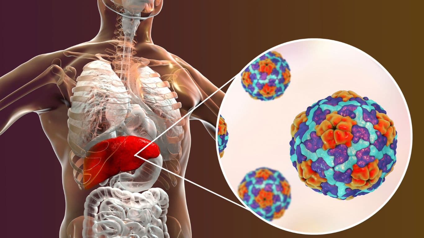 Mengenal Penyakit Hepatitis dan Cara Pencegahannya