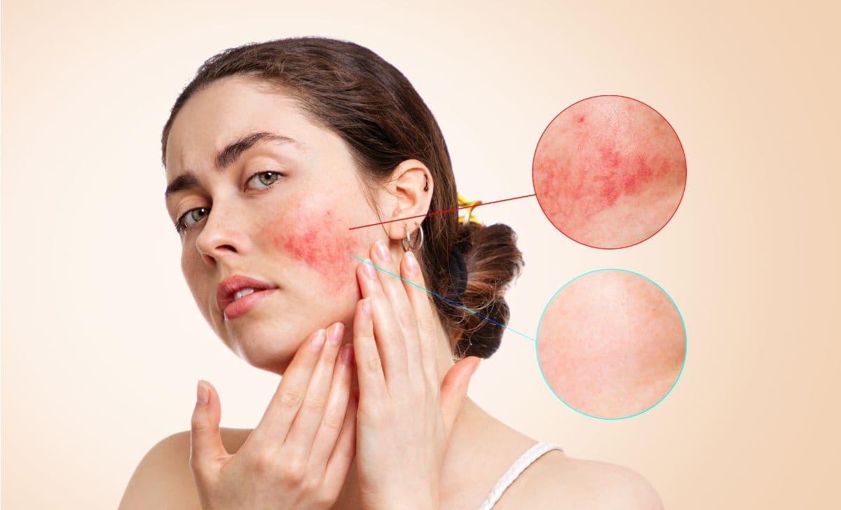 Skincare untuk Kulit Sensitif: Inovasi Produk Terbaru yang Menenangkan