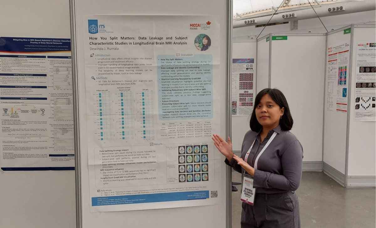 Dukung Diagnosis Penyakit Otak, Doktor ITS Kembangkan AI Berbasis Deep Learning