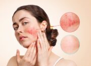 Skincare untuk Kulit Sensitif: Inovasi Produk Terbaru yang Menenangkan