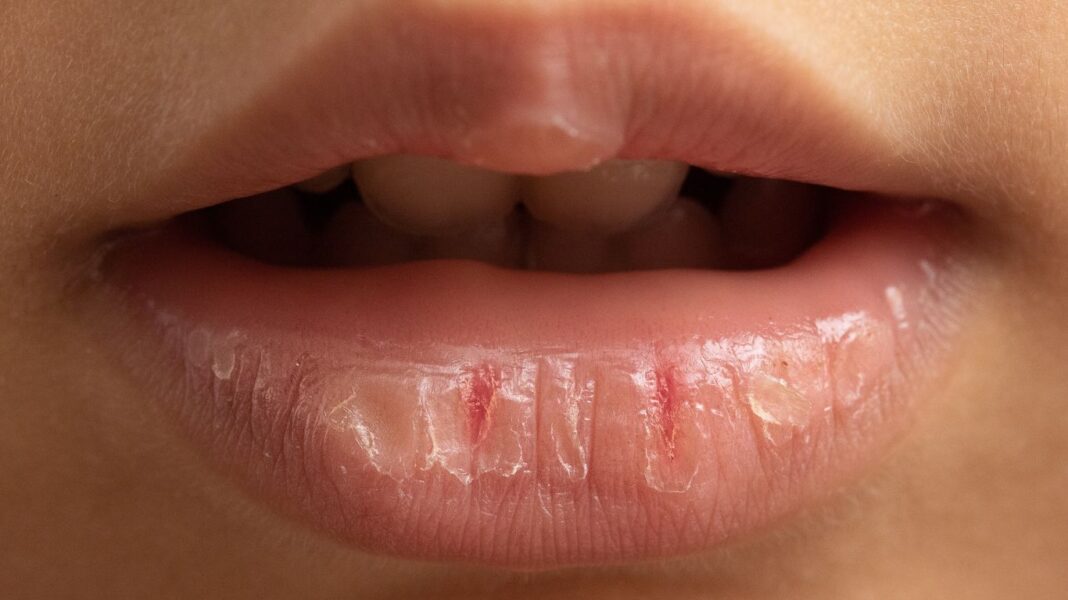 Tips Mengatasi Bibir Kering Karena Lipstik