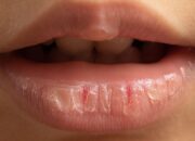 Tips Mengatasi Bibir Kering Karena Lipstik