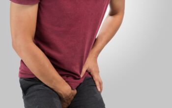 Cara Mengatasi Gatal pada Selangkangan