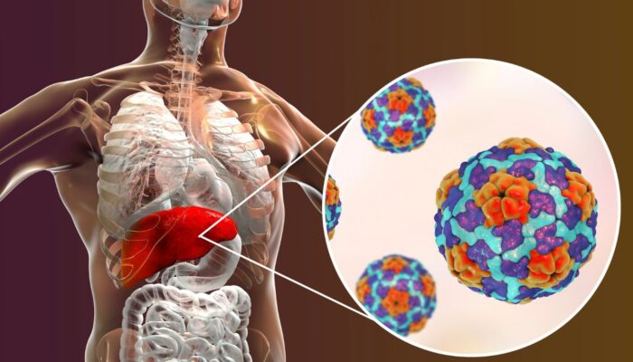 Mengenal Penyakit Hepatitis dan Cara Pencegahannya