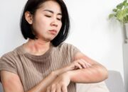 Tips Ampuh! Cara Mengatasi Biduran di Malam Hari