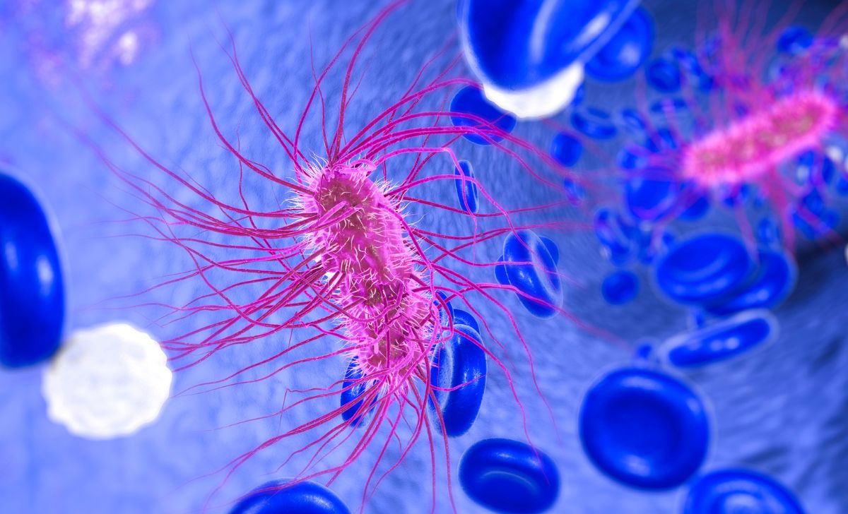 Infeksi E coli di Masa Kanak-Kanak Tingkatkan Risiko Kanker Kolorektal di Usia Muda