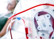 Kenapa Orang Cuci Darah Pasti Meninggal? Ini Penjelasannya!