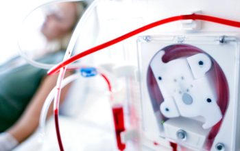 Kenapa Orang Cuci Darah Pasti Meninggal