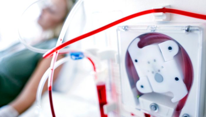 Kenapa Orang Cuci Darah Pasti Meninggal? Ini Penjelasannya!