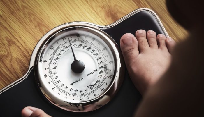 Penelitian Membuktikan Obesitas Dapat Memicu Kecemasan