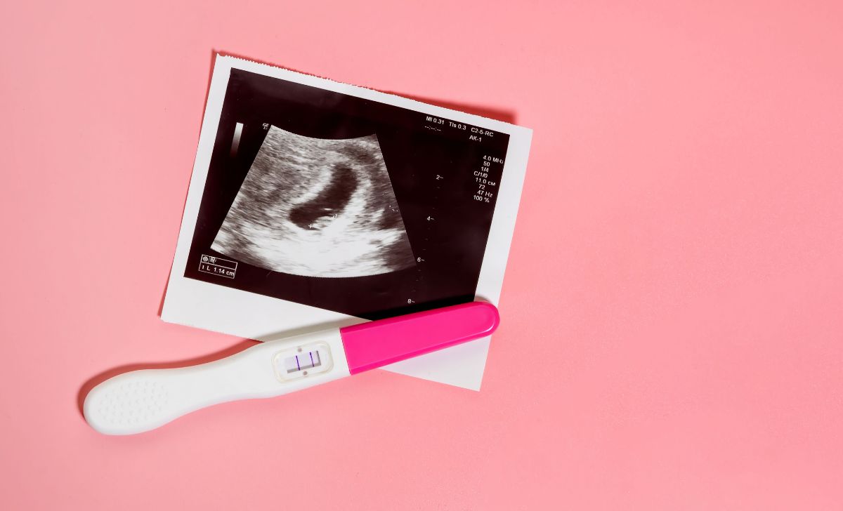 Cara Agar Cepat Hamil Dalam Waktu 1 Minggu