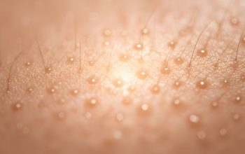 Cara Menghilangkan Chicken Skin di Wajah dengan Langkah Mudah